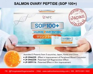 SOP 100+ Adalah