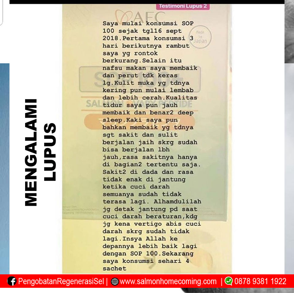 Pengalaman Minum SOP100+ untuk Autoimun
