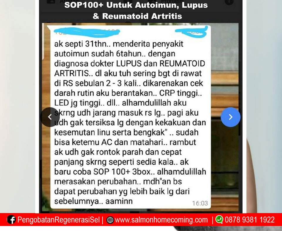 pengobatan autoimun secara alami