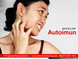 pengobatan penyakit autoimun herbal