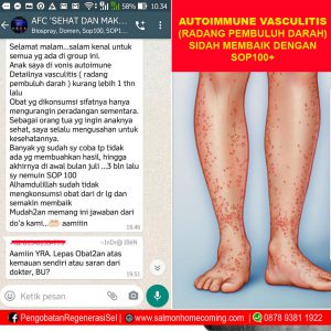 obat herbal radang pembuluh darah
