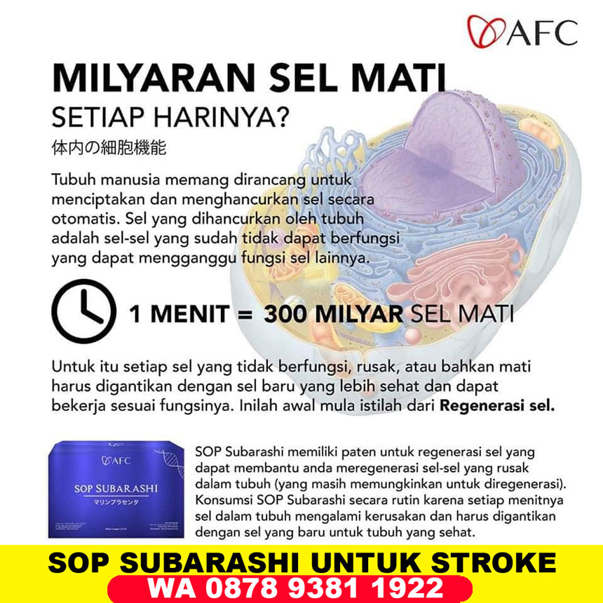 Cara Kerja SOP Subarashi untuk Stroke