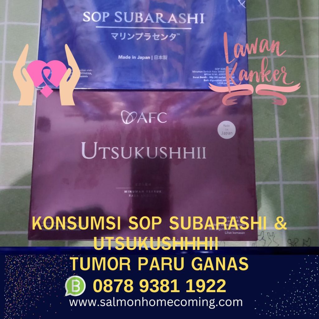 Terapi Tambahan untuk Penderita Tumor Paru Ganas: Minum SOP Subarashi/Utsukuhhii